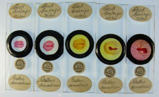 A Fine Group Of 5 Antique Microscope Slides By W.  Watson.  " Chick Embryos ".