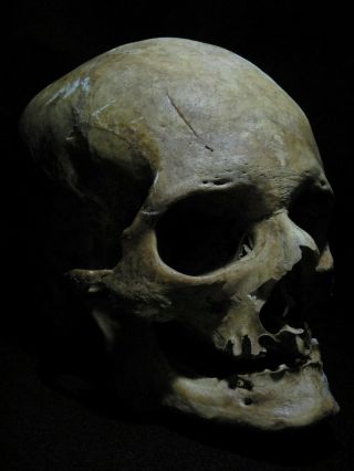 Human Skull 1:1 Scale.  As seen on Netflix. 2