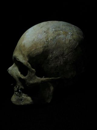 Human Skull 1:1 Scale.  As seen on Netflix. 5