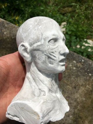 Antique 19th Eartly 20th C Plaster Ecorche Head Bust Artistst Model or Medical 7