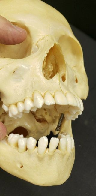 Clay Adams Human Skull Medical School Articulating Jaw 10