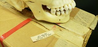 Clay Adams Human Skull Medical School Articulating Jaw 11