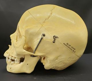 Clay Adams Human Skull Medical School Articulating Jaw 4