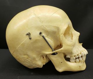 Clay Adams Human Skull Medical School Articulating Jaw 5