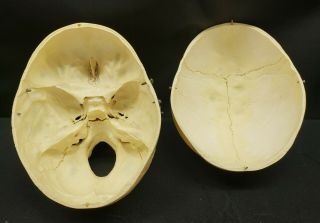 Clay Adams Human Skull Medical School Articulating Jaw 8