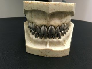 Metal Columbia Dentoform Dental Phantom Manikin Typodont Teeth Study Model