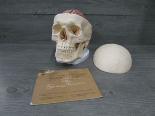 Somso Qs 2/1 Artificial Human Skull Medical Model W/ Brain