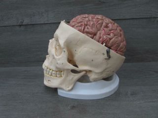 Somso QS 2/1 Artificial Human Skull Medical Model w/ Brain 2