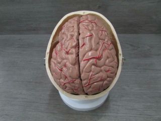 Somso QS 2/1 Artificial Human Skull Medical Model w/ Brain 3