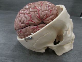 Somso QS 2/1 Artificial Human Skull Medical Model w/ Brain 6