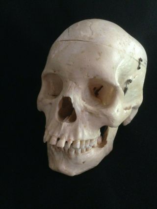 Human Skull For Scientific Study From Clay Adams Inc.  Estate Item