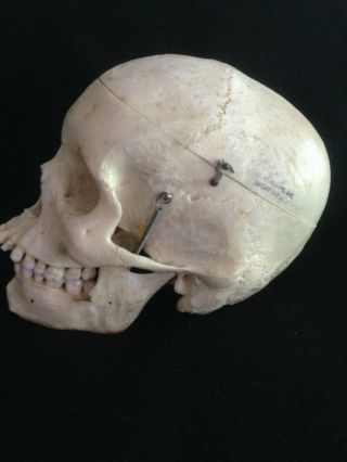 Human Skull For Scientific Study From Clay Adams Inc.  Estate Item 2