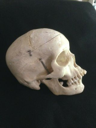 Human Skull For Scientific Study From Clay Adams Inc.  Estate Item 3