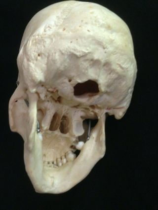 Human Skull For Scientific Study From Clay Adams Inc.  Estate Item 5