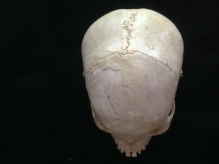 Human Skull For Scientific Study From Clay Adams Inc.  Estate Item 6