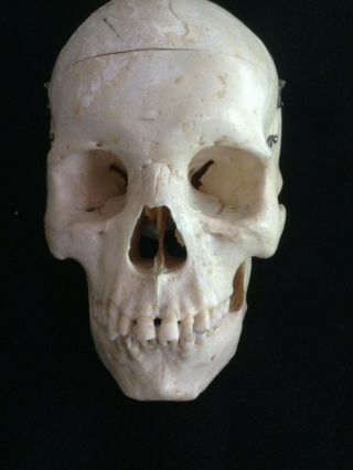 Human Skull For Scientific Study From Clay Adams Inc.  Estate Item 8