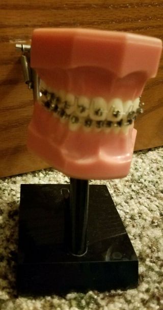 Dental Ortho Orthodontist Orthodontic Demo Display Model Vintage Medical Hygiene
