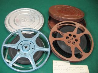 16mm Reels Of Medical Procedure Film Vintage 8mm & 16mm Not Viewed