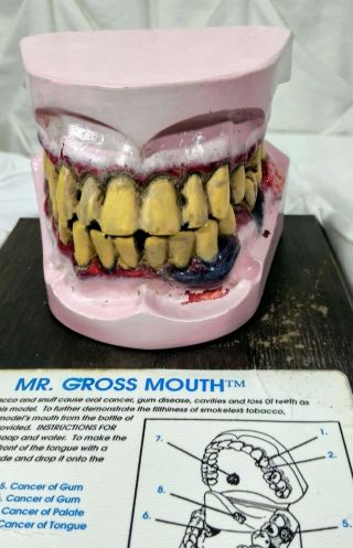 Mr.  Gross Mouth Tobacco Classroom Educational Mouth Model Dental Health Edco
