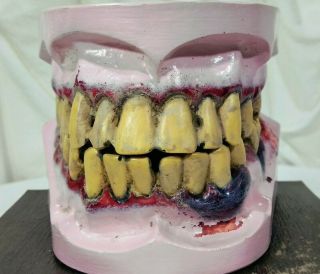 Mr.  Gross Mouth Tobacco Classroom Educational Mouth Model Dental Health EDCO 3