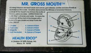 Mr.  Gross Mouth Tobacco Classroom Educational Mouth Model Dental Health EDCO 5