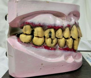 Mr.  Gross Mouth Tobacco Classroom Educational Mouth Model Dental Health EDCO 7