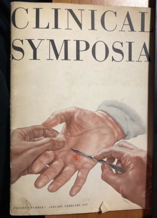 1957 Medical Book / Clinical Symposia / Surgical Anatomy Of The Hand