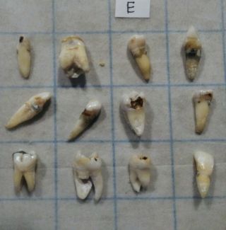 12 Vintage Real Human Teeth.  Inv E