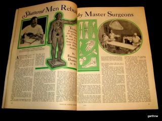 Bone Surgery 1933 Vintage Orthopedics Surgeon Pictorial Thrilling Experiences