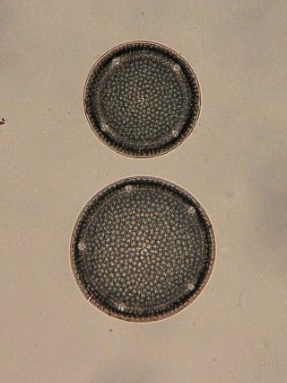 Antique Microscope Slide By J.  D.  Moller.  Diatoms.  Eupodiscus Velatus.