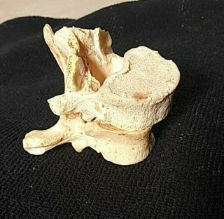 Real Human Bone Vertebrae Antique Medical Specimen