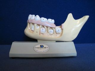 Vintage Nystrom Biological Life Like Models Jaw/tooth Anatomical Education Model