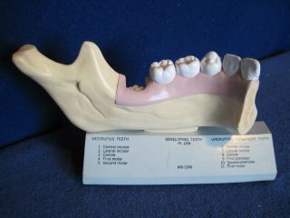 Vintage Nystrom Biological Life Like Models Jaw/Tooth Anatomical Education Model 2