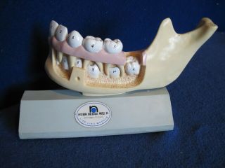 Vintage Nystrom Biological Life Like Models Jaw/Tooth Anatomical Education Model 3