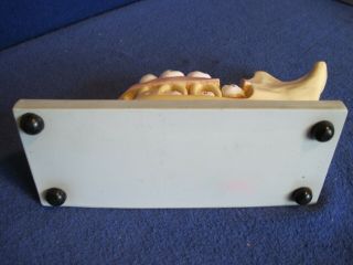 Vintage Nystrom Biological Life Like Models Jaw/Tooth Anatomical Education Model 4