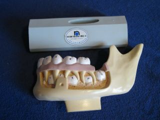 Vintage Nystrom Biological Life Like Models Jaw/Tooth Anatomical Education Model 5
