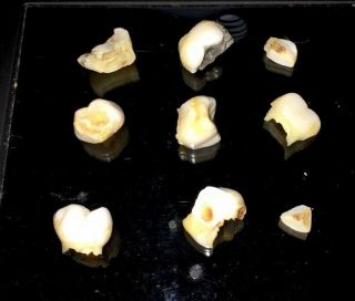 Real Human Teeth For Research 9 Small