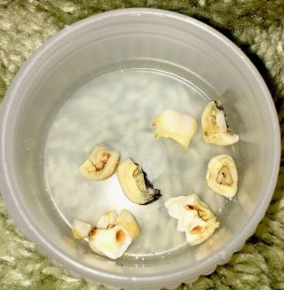 Real Human Teeth For Research 9 Small 2