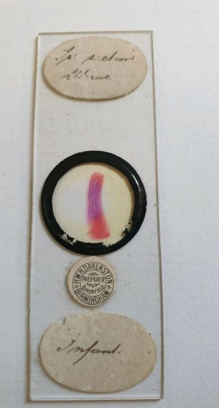 Fine Antique Microscope Slide " Section Of Uterus Infant " By H.  W.  H.  Darlaston