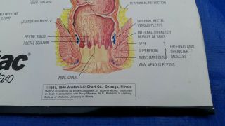 VTG Medical Sign Chart Human 1986 Digestive System Anatomy Glaxo Zantac Display 5
