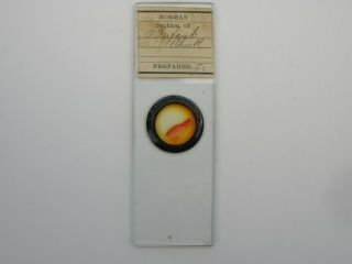 Antique Microscope Slide.  Section Of Cheek Of An Infant By Norman