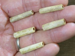 5 Woodland - Mississippian Highly Polished Bone Beads,  Eastern Tn,  X Beutell
