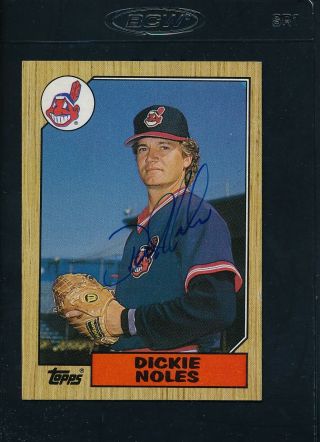 1987 Topps 244 Dickie Noles Indians Signed Auto 44365