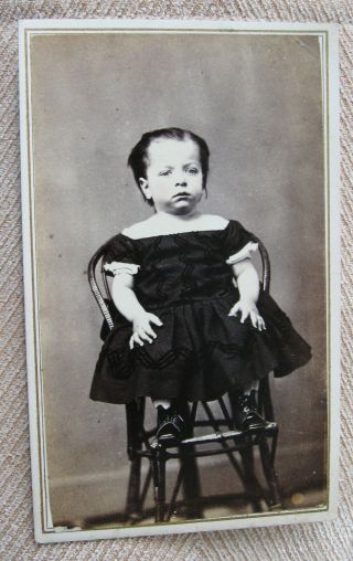 Antique Cw Era Cdv Photo Cute Little Boy Wearing A Dress Hannibal Mo Tax Stamp