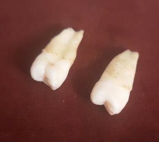 Real Human Teeth Same Person 2 Pulled Extracted Teeth With Roots Rare