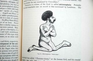 Anomalies & Curiosities Of Medicine.  Rare Sideshow Freaks Book Photos & Drawings