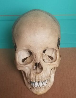 Early Rare Real Womans Human Skull Spring Jaw Medical Dental