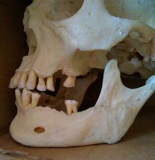 Human Skull Medical Dental Teaching Training Vintage Rare Clay Adams 3